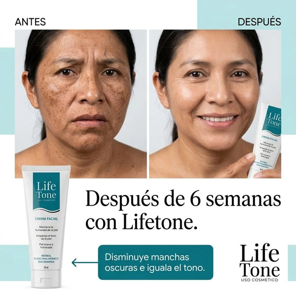 Lifetone Corrector de Manchas